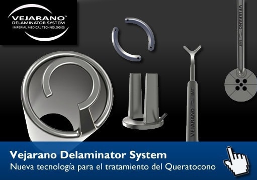 Vejarano Delaminator System